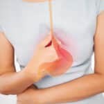 Doença do refluxo gastroesofágico: O que é impedâncio- pHmetria esofágica prolongada? Quais as indicações desse exame?
