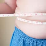Obesidade aumenta as chances de contrair covid-19? Saiba quais doenças têm a obesidade como fator de risco