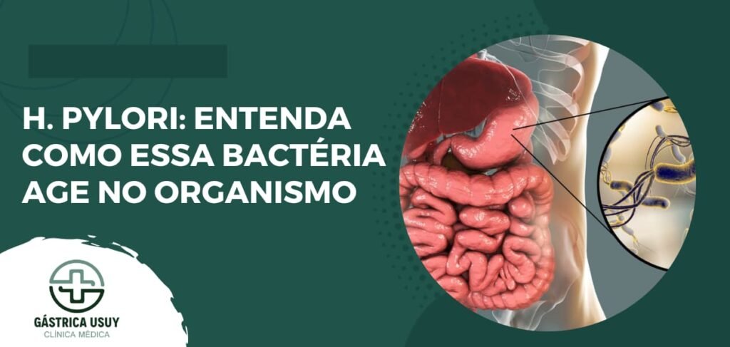 H. Pylori: Entenda como essa bactéria age no organismo