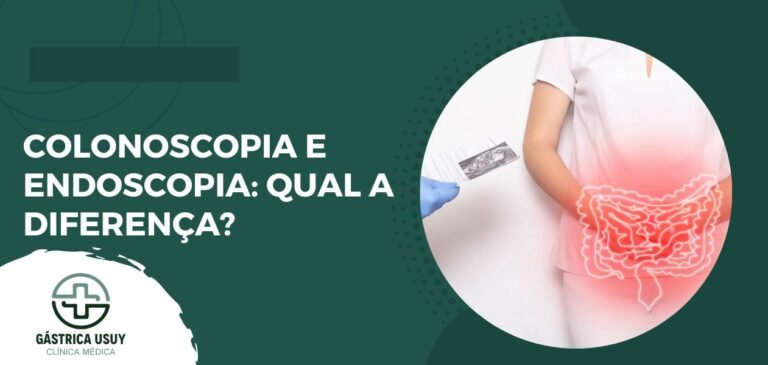 Colonoscopia e Endoscopia: Qual a diferença?