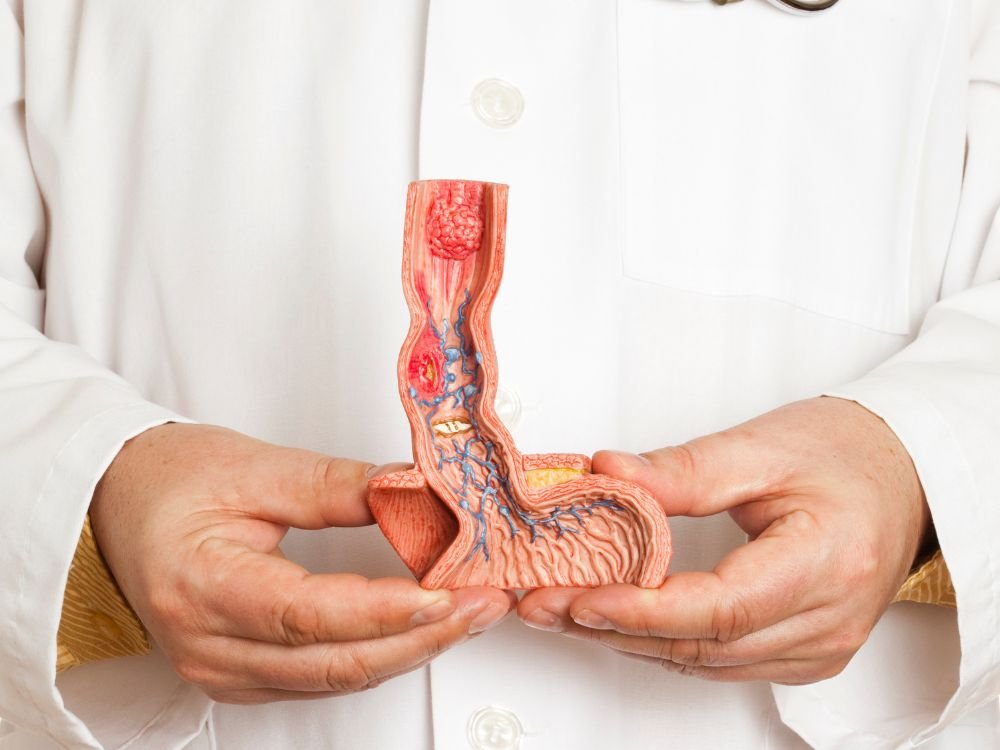 Em diferentes casos o médico solicita a phmetria