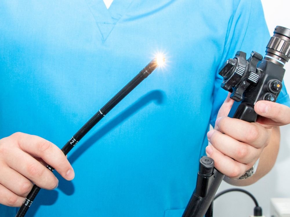 Detalhe do aparelho utilizado em gastroplastia endoscópica, essencial para entender o que é gastroplastia endoscopia e como é feita.