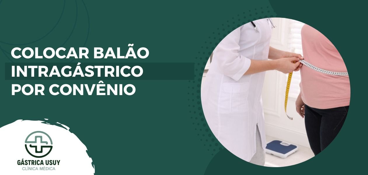 Imagem ilustrativa com médica medindo circunferência abdominal de paciente ao lado da frase colocar balão intragástrico por convênio.