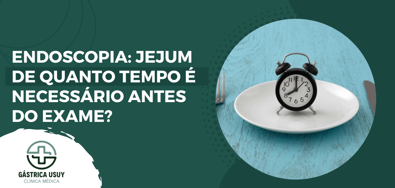 Relógio sobre prato representando o tempo de jejum necessário antes da endoscopia, conforme orientações médicas para realização segura do exame.