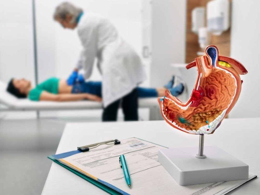 Modelo anatômico do estômago em consultório médico durante avaliação clínica, explicando visualmente se endoscopia dói e como o procedimento funciona.