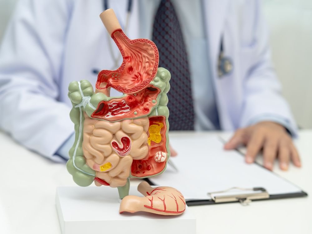 Modelo anatômico do sistema digestivo usado para explicar “Transplante de fezes Como é feito” em consulta médica especializada.