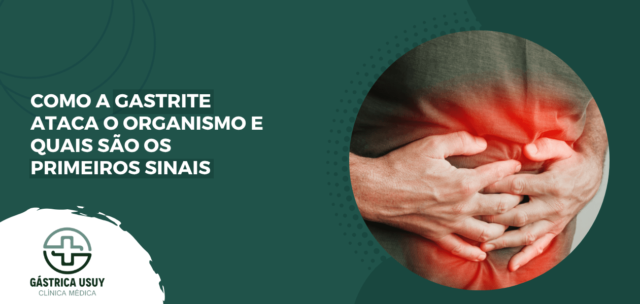 Capa de artigo sobre como a gastrite ataca o organismo, com ilustração de dor na região do estômago.