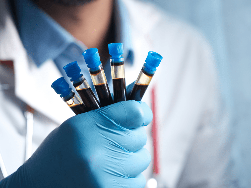 Profissional de saúde com luva azul segura vários tubos de coleta contendo amostras de sangue para análise laboratorial.