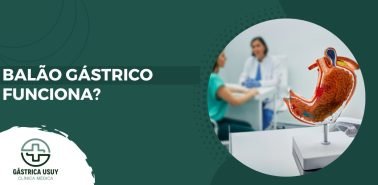 Banner com a frase 'Balão gástrico funciona?', ao lado de modelo anatômico do estômago e consulta médica ao fundo. Clínica Gástrica Usuy.