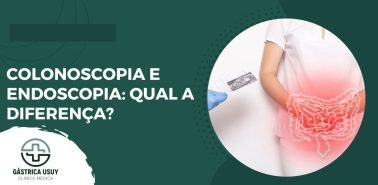 Colonoscopia e endoscopia