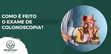 Imagem ilustrativa sobre como é feito o exame de colonoscopia, com um profissional de saúde segurando um modelo anatômico do intestino grosso e uma lupa destacando detalhes da estrutura intestinal. Layout da Clínica Gástrica Usuy.