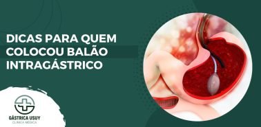Banner com ilustração do balão intragástrico dentro do estômago, acompanhado do texto 'Dicas para quem colocou balão intragástrico', destacando orientações pós-tratamento.