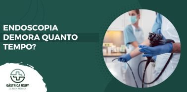 Imagem ilustrativa sobre endoscopia demora quanto tempo, com equipe médica segurando um endoscópio durante o procedimento. Layout da Clínica Gástrica Usuy.