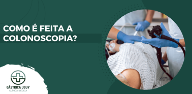 Banner com equipe médica realizando o exame em paciente sedado, ilustrando como é feita a colonoscopia em ambiente hospitalar, com acompanhamento profissional.