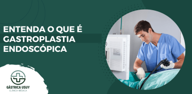 Banner informativo da Clínica Gástrica Usuy com médico realizando procedimento e frase explicativa sobre o que é gastroplastia endoscopia.