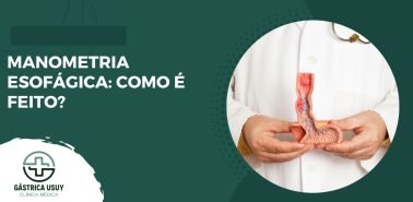 Manometria Esofágica Como é feito-entenda