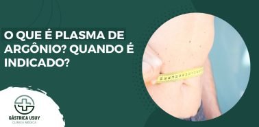 Banner informativo com o texto 'O que é plasma de argônio? Quando é indicado?', acompanhado de imagem de pessoa medindo a circunferência abdominal com fita métrica. Design em tons verdes com logotipo de clínica médica, representando saúde, emagrecimento e procedimentos médicos.
