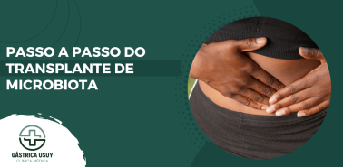 Arte informativa com o título “Passo a passo do transplante de microbiota” e imagem ilustrando desconforto abdominal relacionado à saúde intestinal.