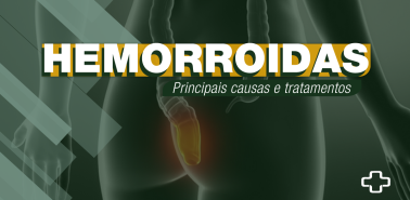 Post-Usuy-Hemorroida-capablog
