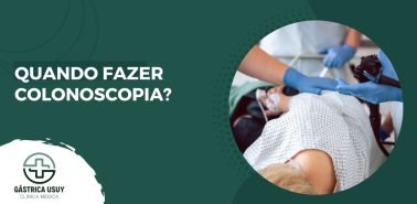 Quando fazer Colonoscopia?