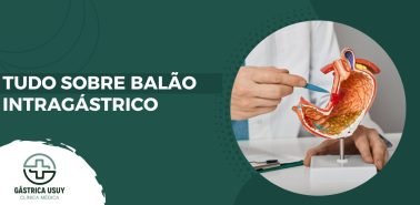 Banner com a frase 'Tudo sobre Balão intragástrico, ao lado de médico explicando modelo anatômico do estômago. Clínica Gástrica Usuy.