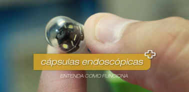 USUY-CapsulasEndoscopi-02
