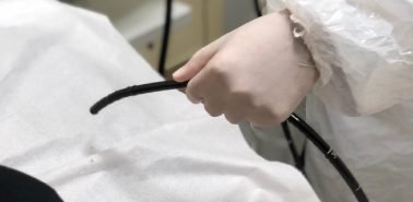 Usuy-blog-endoscopia_BLOG-1