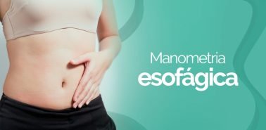 manometria