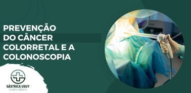 Banner informativo com o texto "Prevenção do câncer colorretal e colonoscopia", ao lado da imagem de um profissional da saúde segurando um colonoscópio em ambiente clínico.