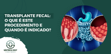 transfplante fecal